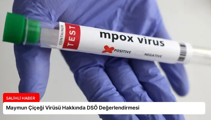 Maymun Çiçeği Virüsü Hakkında DSÖ Değerlendirmesi