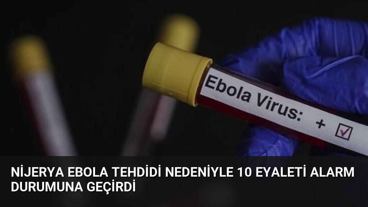 Nijerya Ebola Tehdidi Nedeniyle 10 Eyaleti Alarm Durumuna Geçirdi